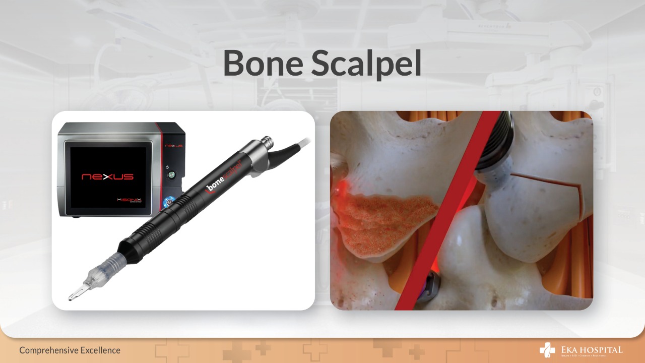 Ultrasonic Bone Scalpel